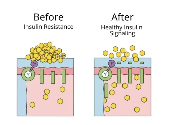 Insulin resistance